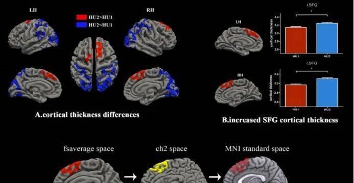 如何在Ubuntu服务器上安装桌面环境（GUI）